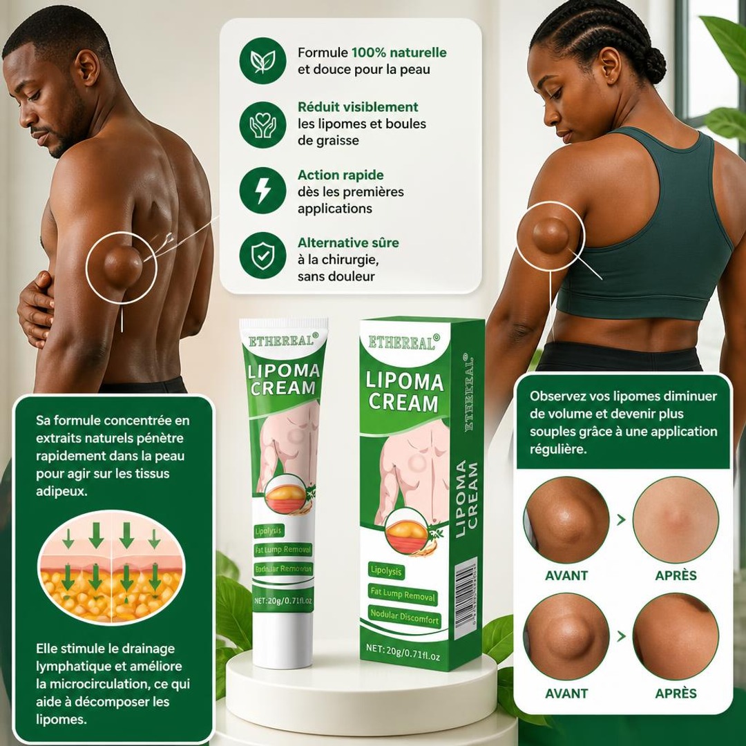 La crème Lipoma Cream Original est formulée pour cibler les lipomes en douceur