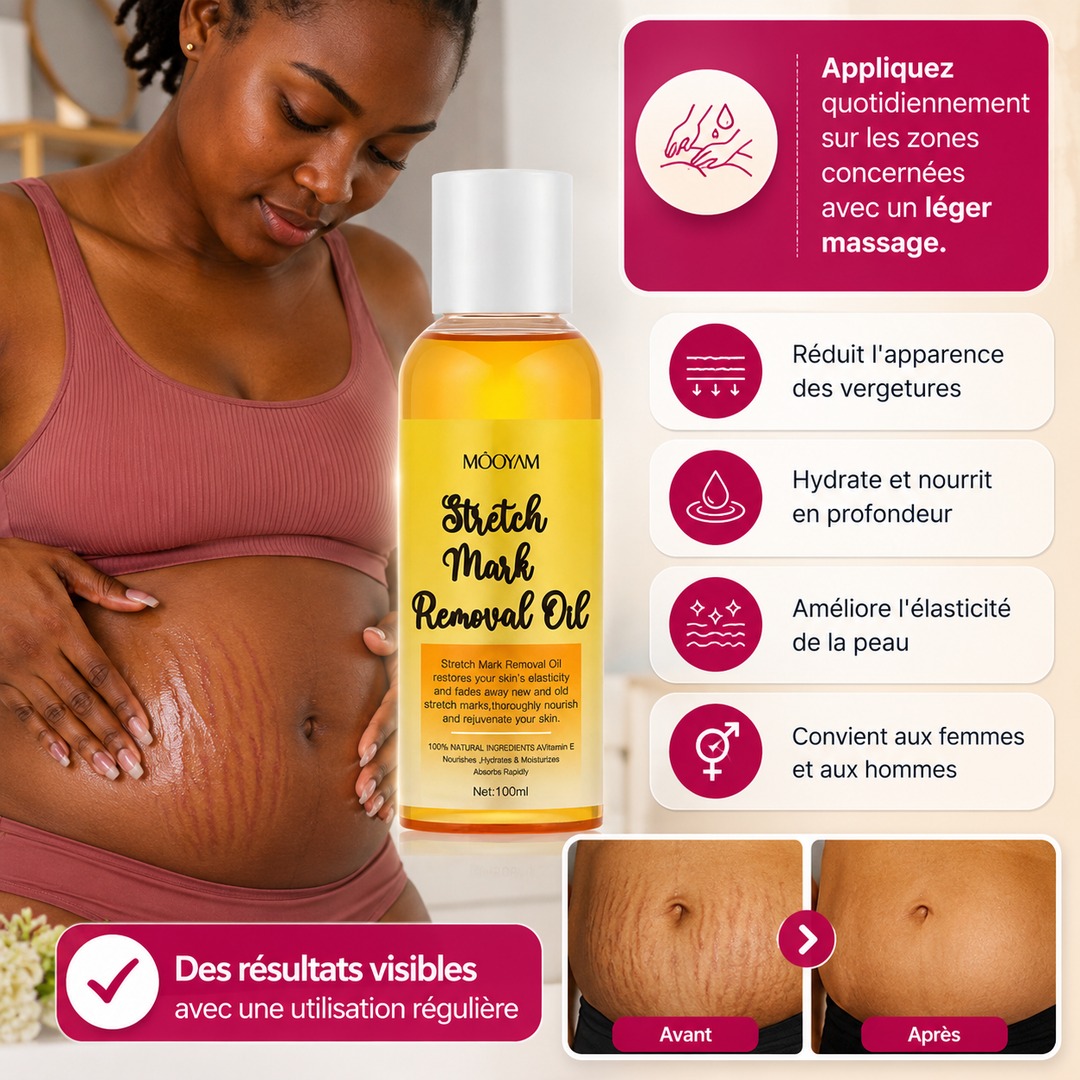 Comment utiliser notre huile anti-vergetures ?